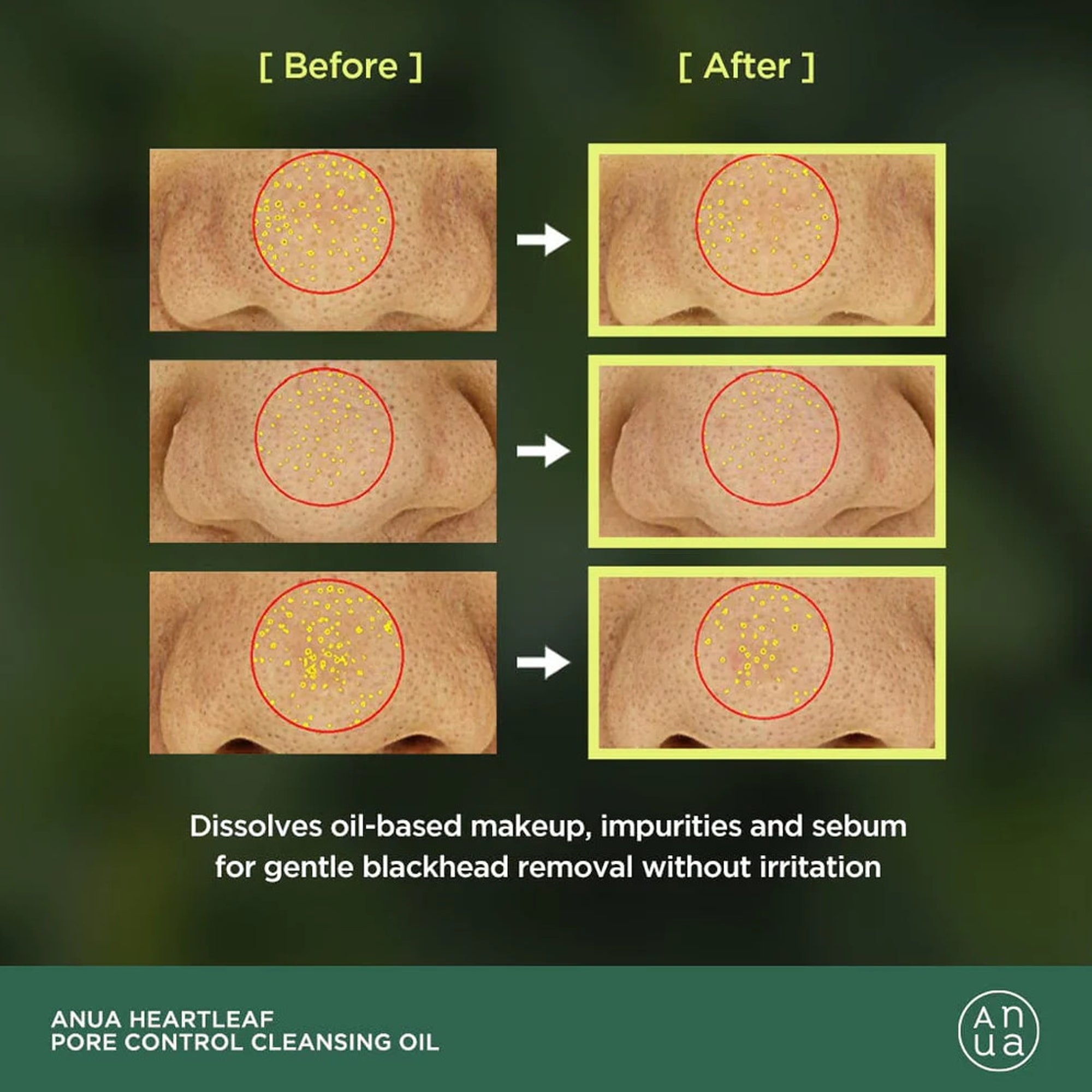 Revolution Super Concealer Radiant Matte C8.5