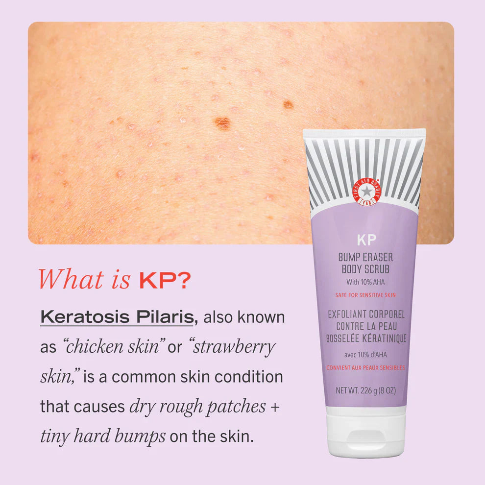 First Aid Beauty KP Bump Eraser Body Scrub with 10% AHA 56g