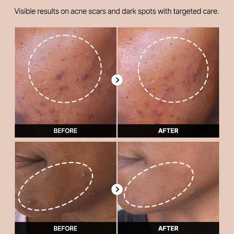 The Alpha-Arbutin 2% Discoloration Care Serum for brighter skin