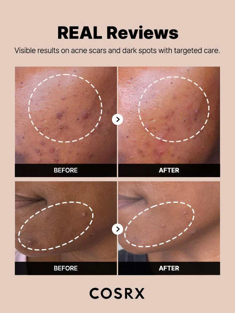 The Alpha-Arbutin 2% Discoloration Care Serum for brighter skin