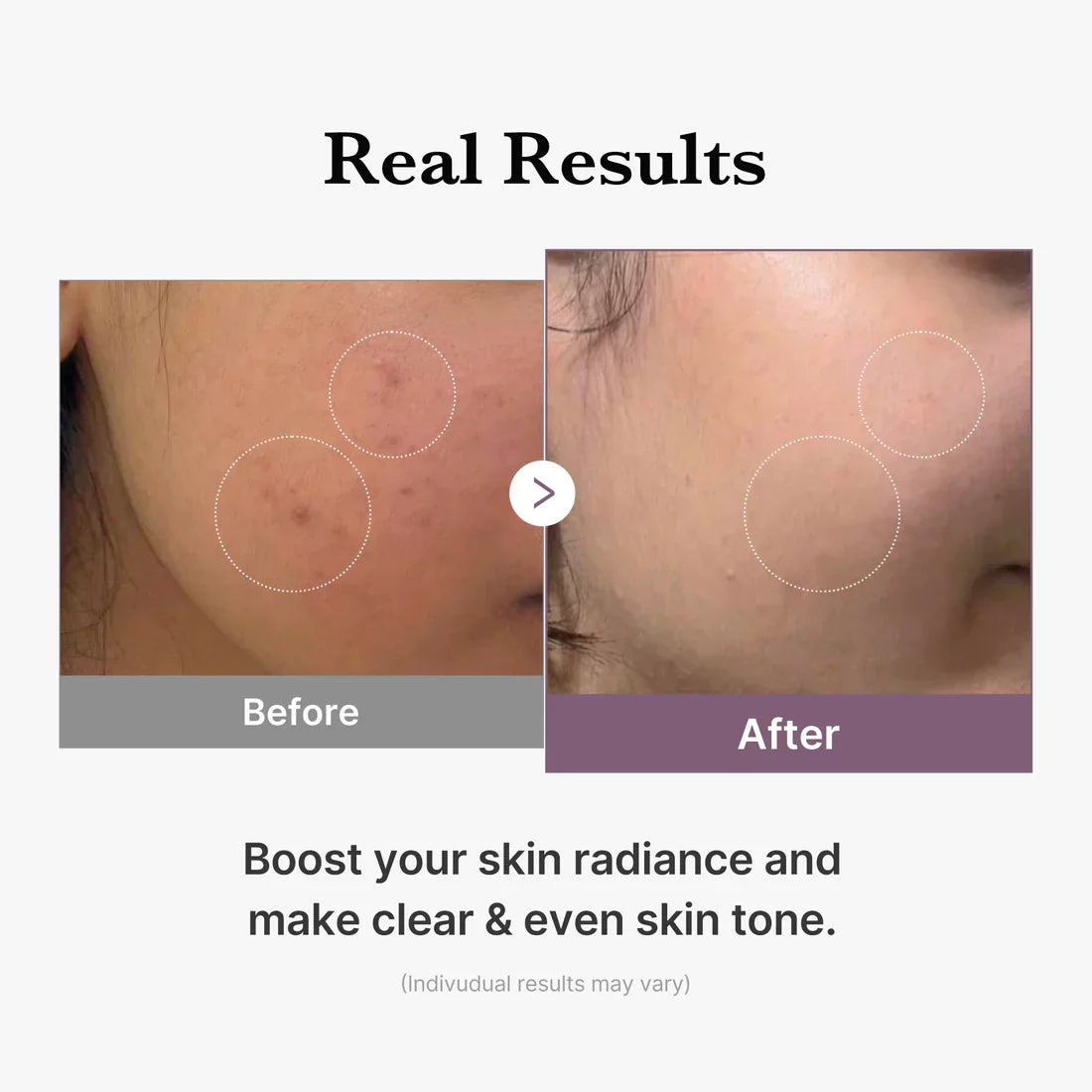 Medicube Age-R Vita C Pro Ampoule for radiant skin