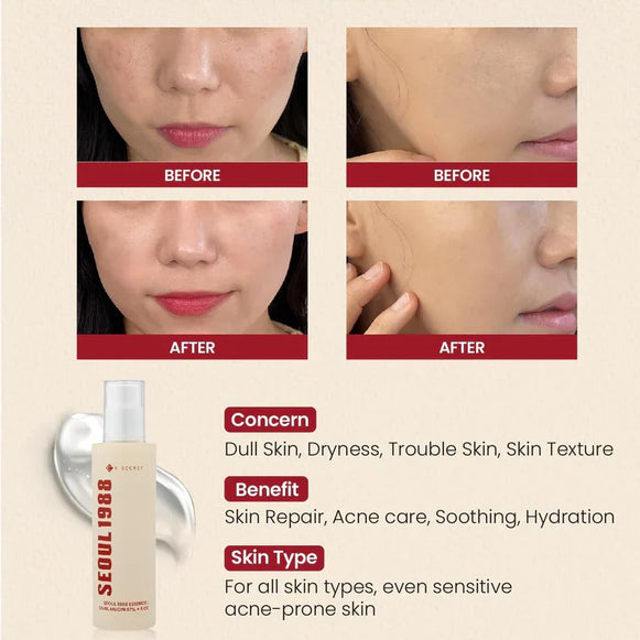 K-Secret Seoul 1988 Essence with Snail Mucin 97% and Rice for intense hydration