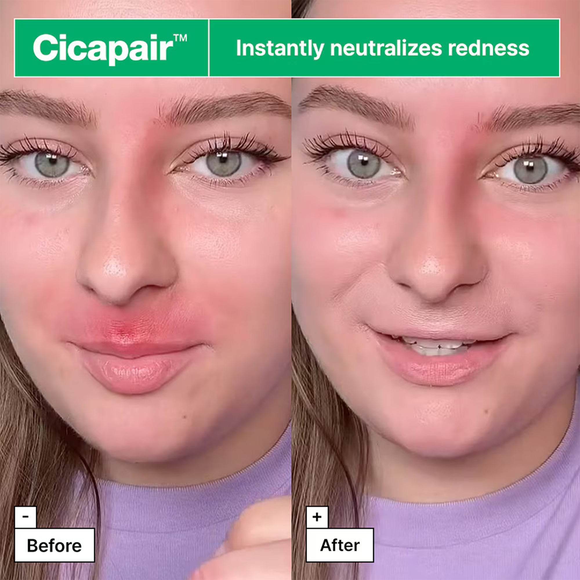 Carmex Classic Lip Balm Medicated Lip Protected 7.5gm