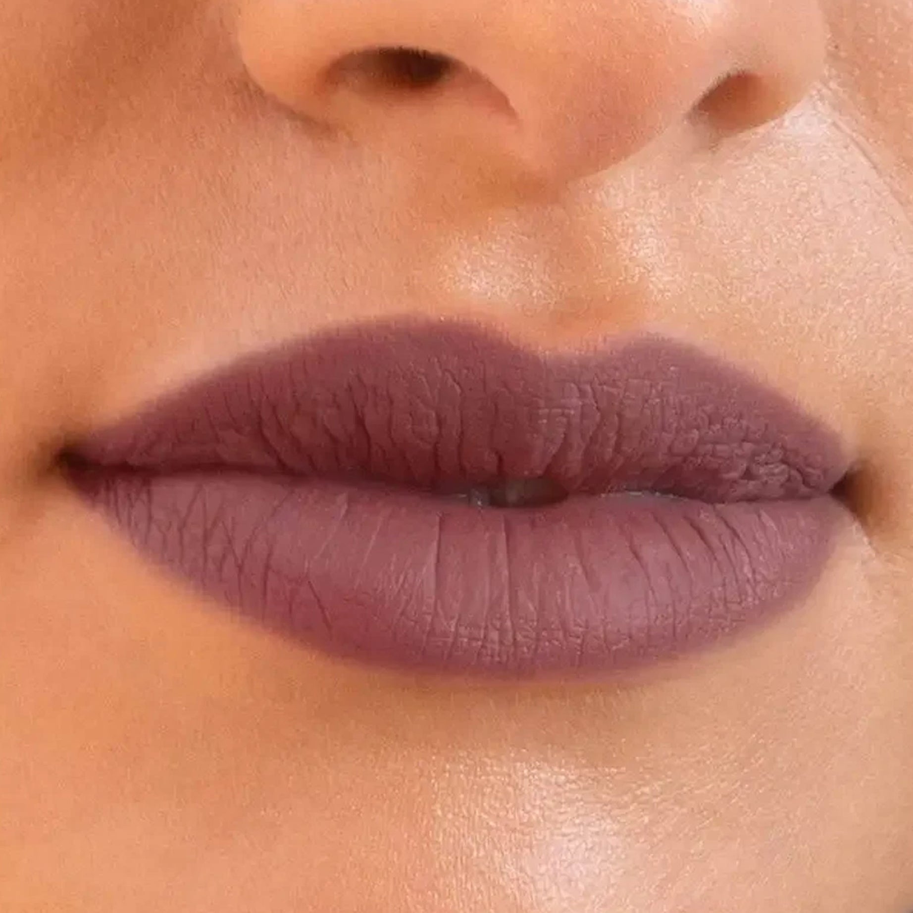 Rederm Aesthetics Tressfix Multivitamin Tablet For Hair