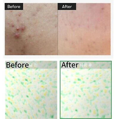 VT Cica Reedle Shot 100 Essence (50ml) (95000 Cica Reedle)