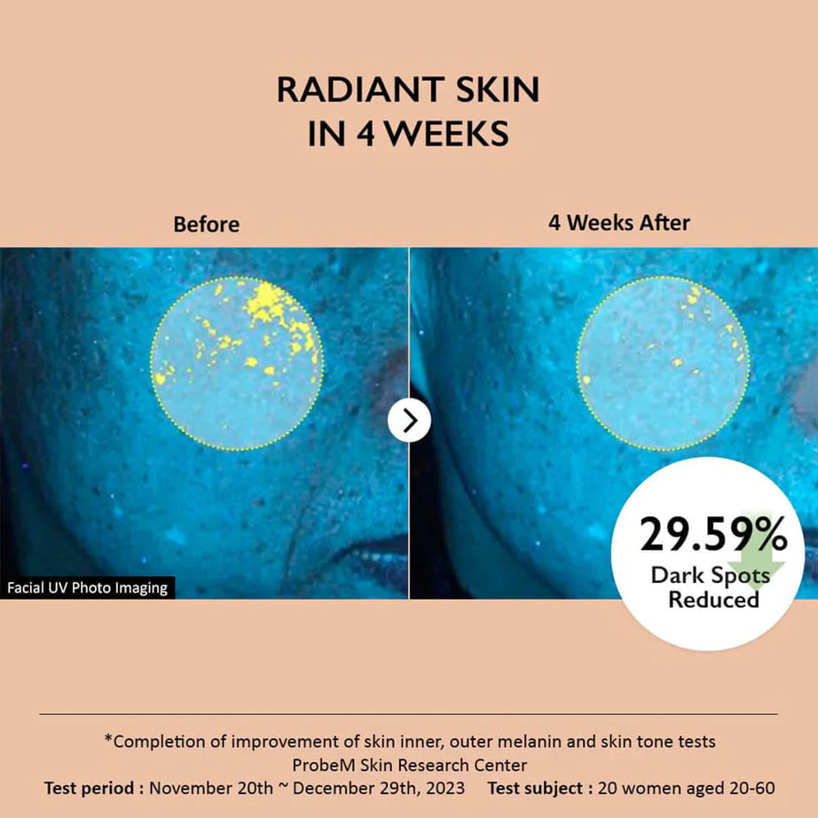 Haruharu Wonder Centella 4% TXA Dark Spot Go Away Serum for clear skin