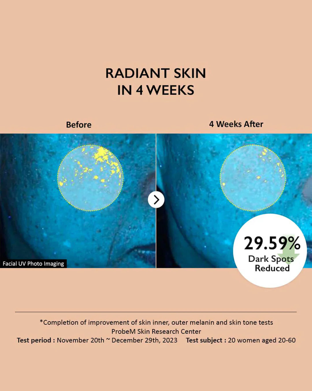 Haruharu Wonder Centella 4% TXA Dark Spot Go Away Serum for clear skin