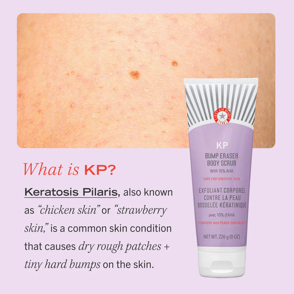 First Aid Beauty KP Bump Eraser Body Scrub with 10% AHA 56g