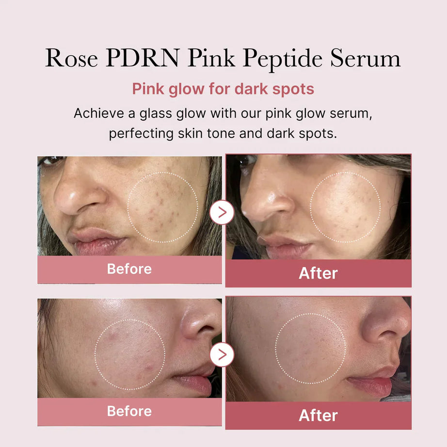 Medicube PDRN Pink Peptide Serum for Skin Regeneration
