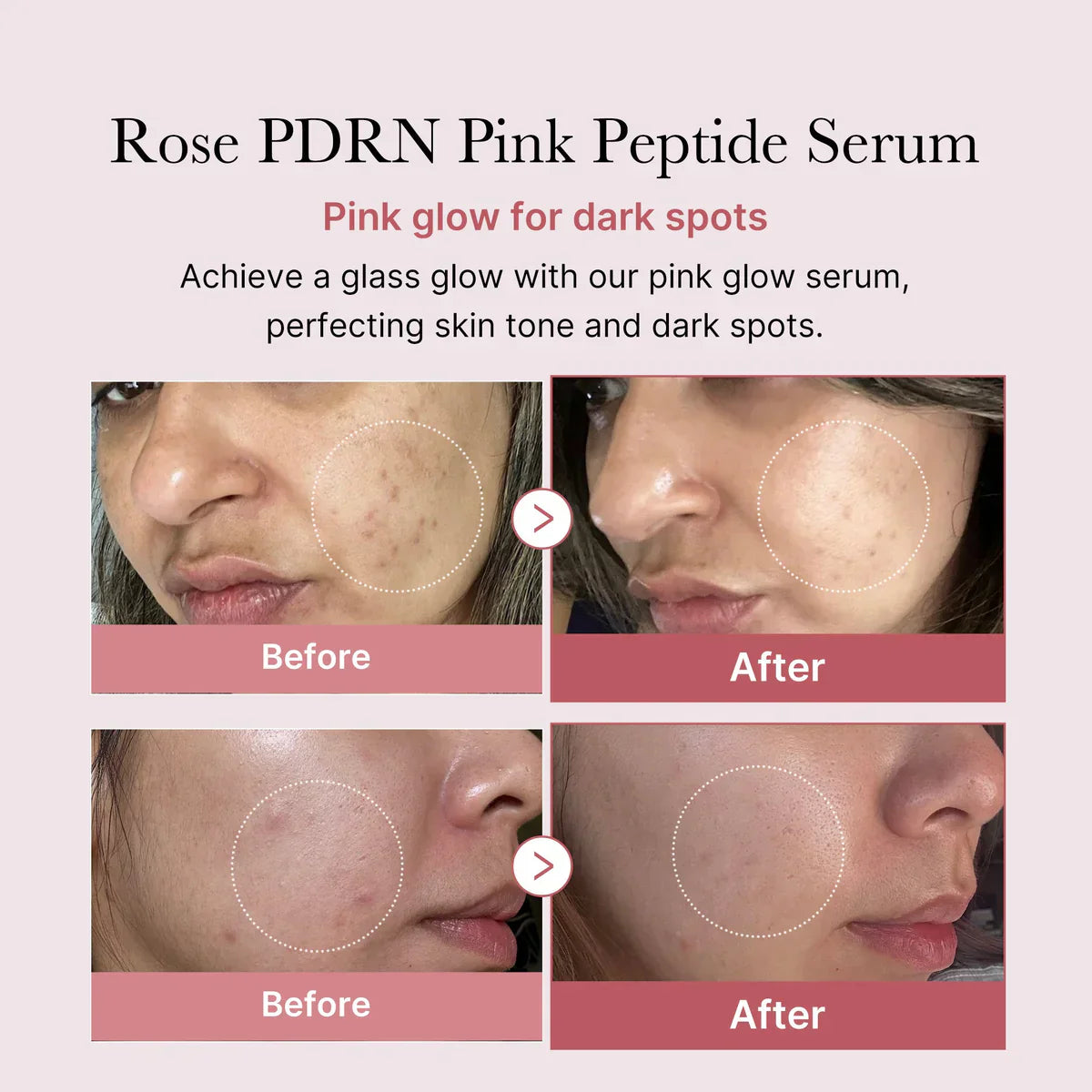 Medicube PDRN Pink Peptide Serum for Skin Regeneration