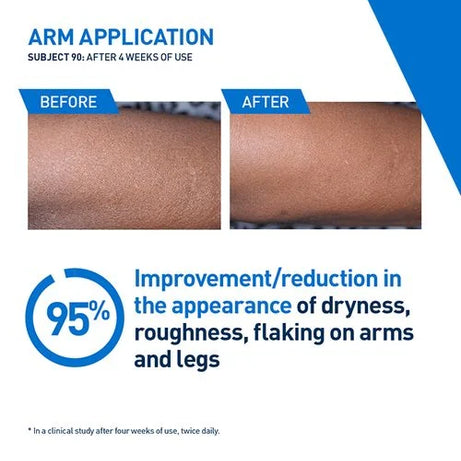 CeraVe Intensive Moisturizing Lotion 355ml