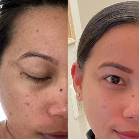 Medicube Deep Vita C Ampoule Set for Skin Glow & Radiance