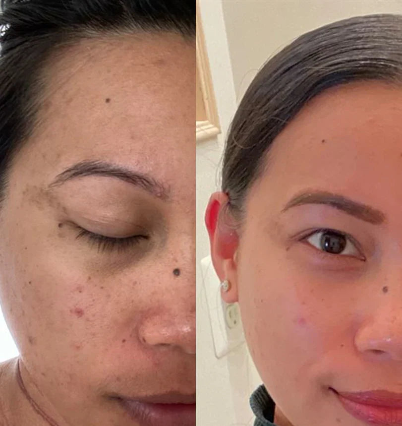 Medicube Deep Vita C Ampoule Set for Skin Glow & Radiance