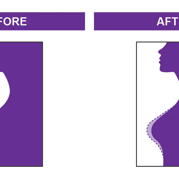 SU Natural Cream (125ml)