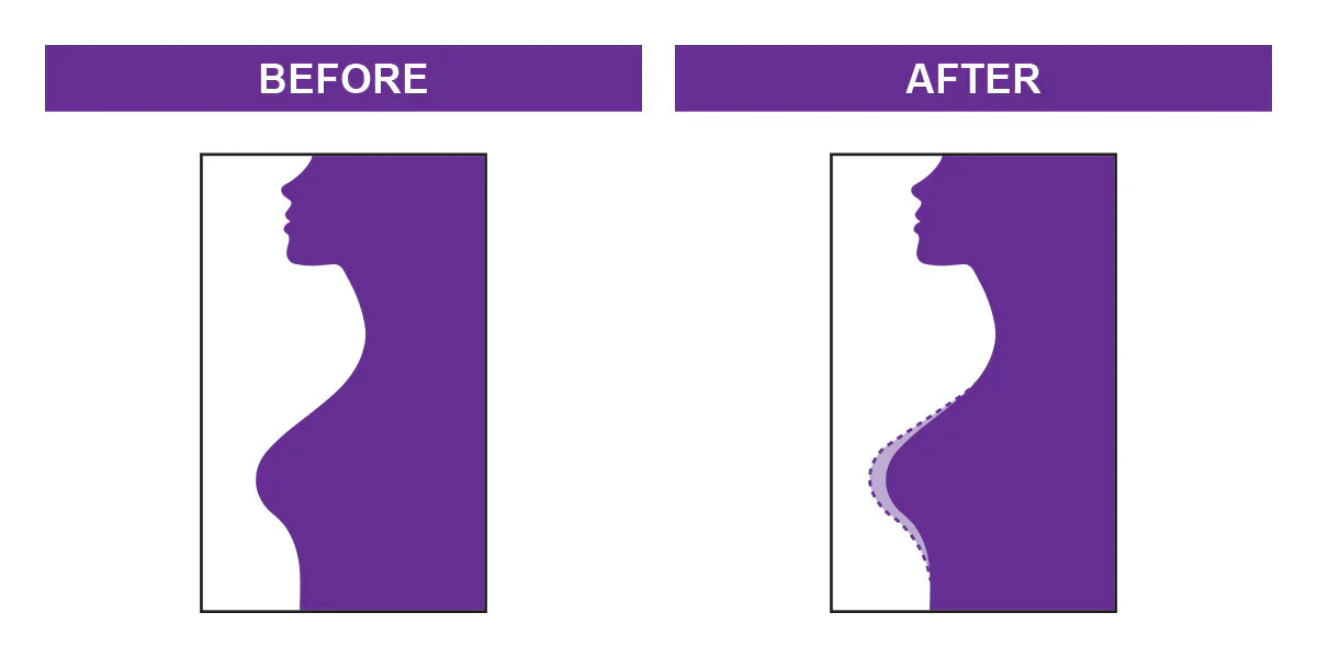 SU Natural Cream (125ml)